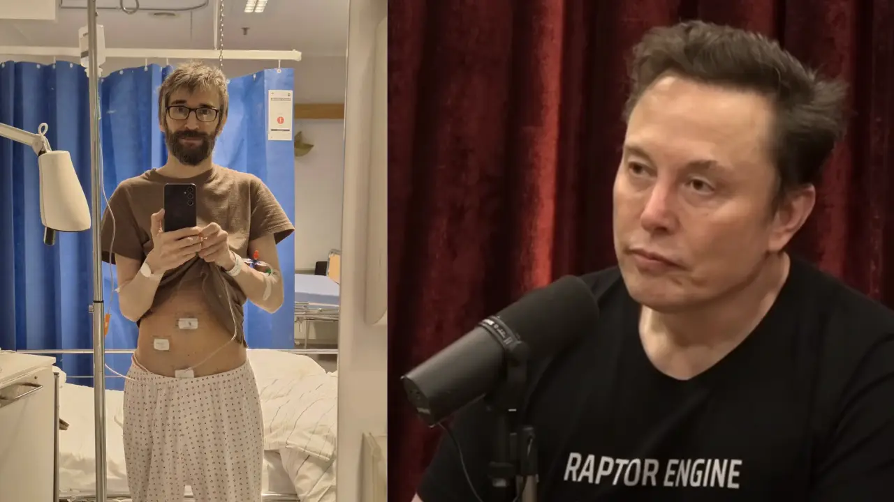 Grok AI helped detect appendicitis? Elon Musk says Grok can read X-rays and MRIs more accurately