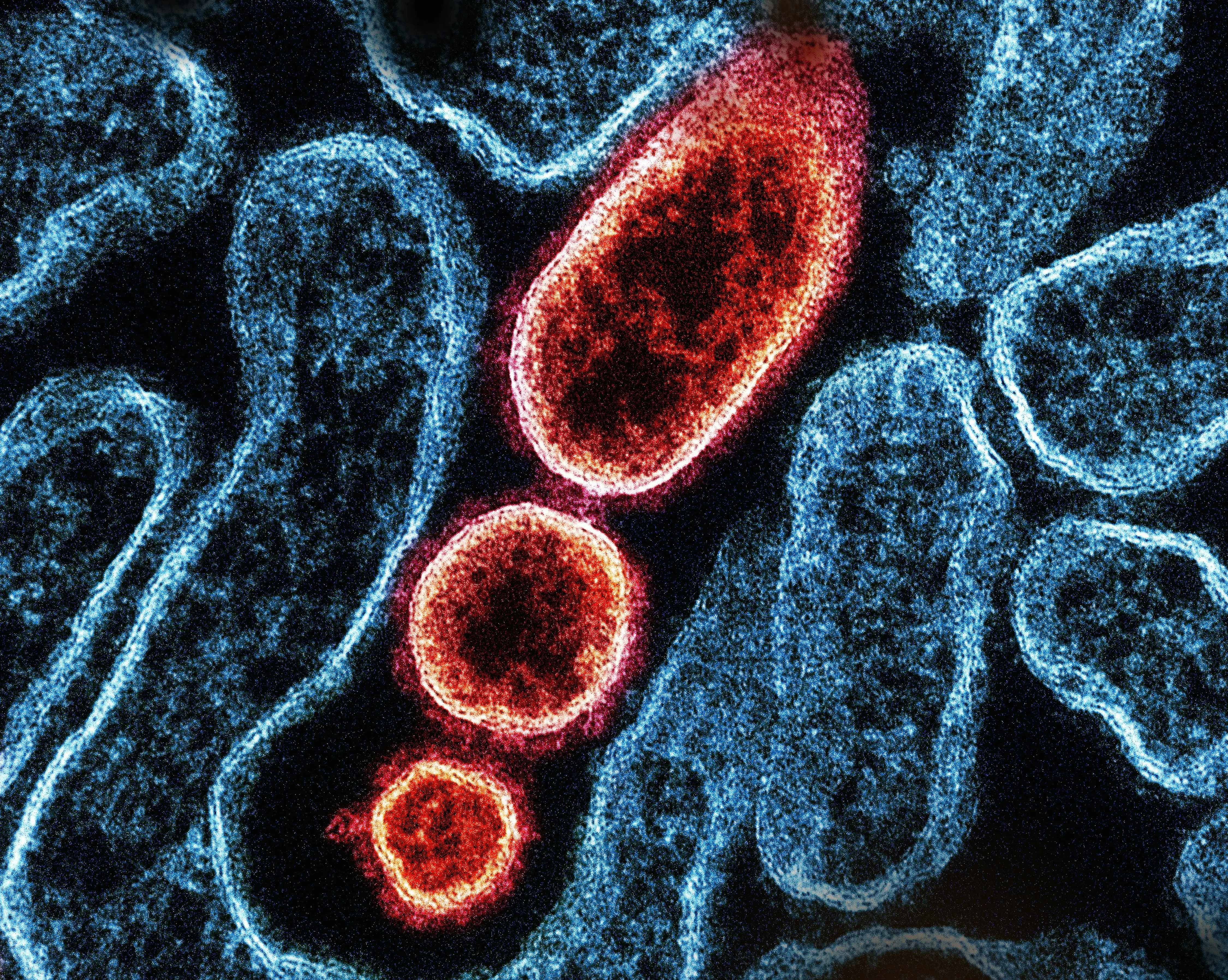 Nipah virus detected in West Bengal? Early symptoms and signs you must know