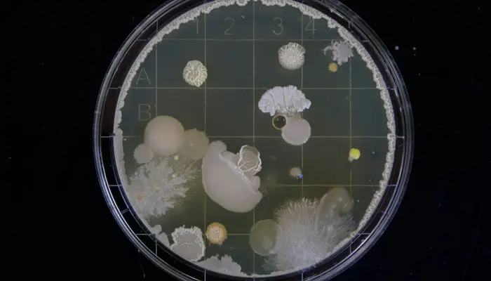 Deadly fungal infection surging through US: Symptoms, prevention and, affected states