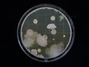 Deadly fungal infection surging through US: Symptoms, prevention and, affected states