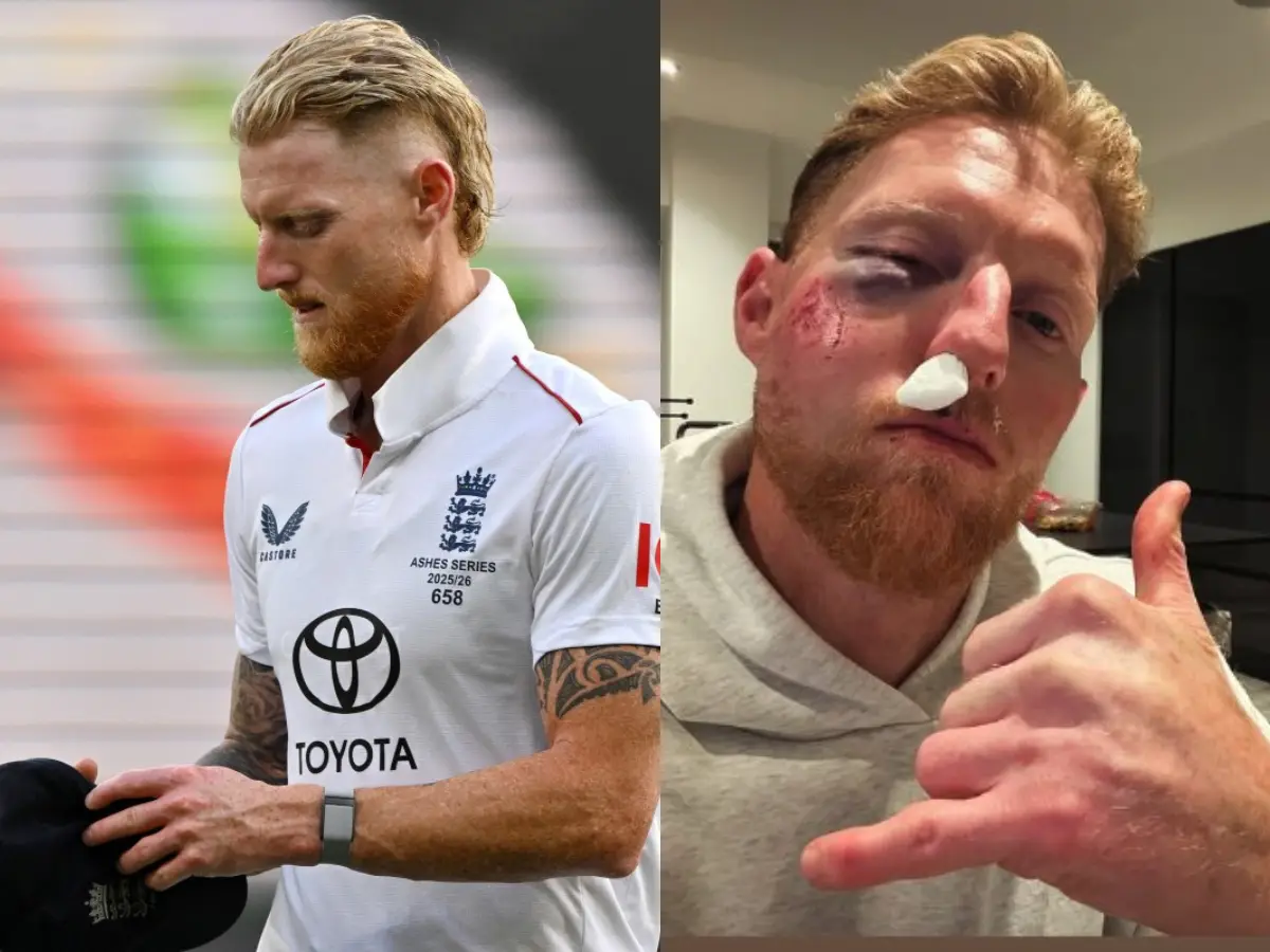 Ben Stokes brutally injured in training, reveals severely bruised right eye, bleeding nose
