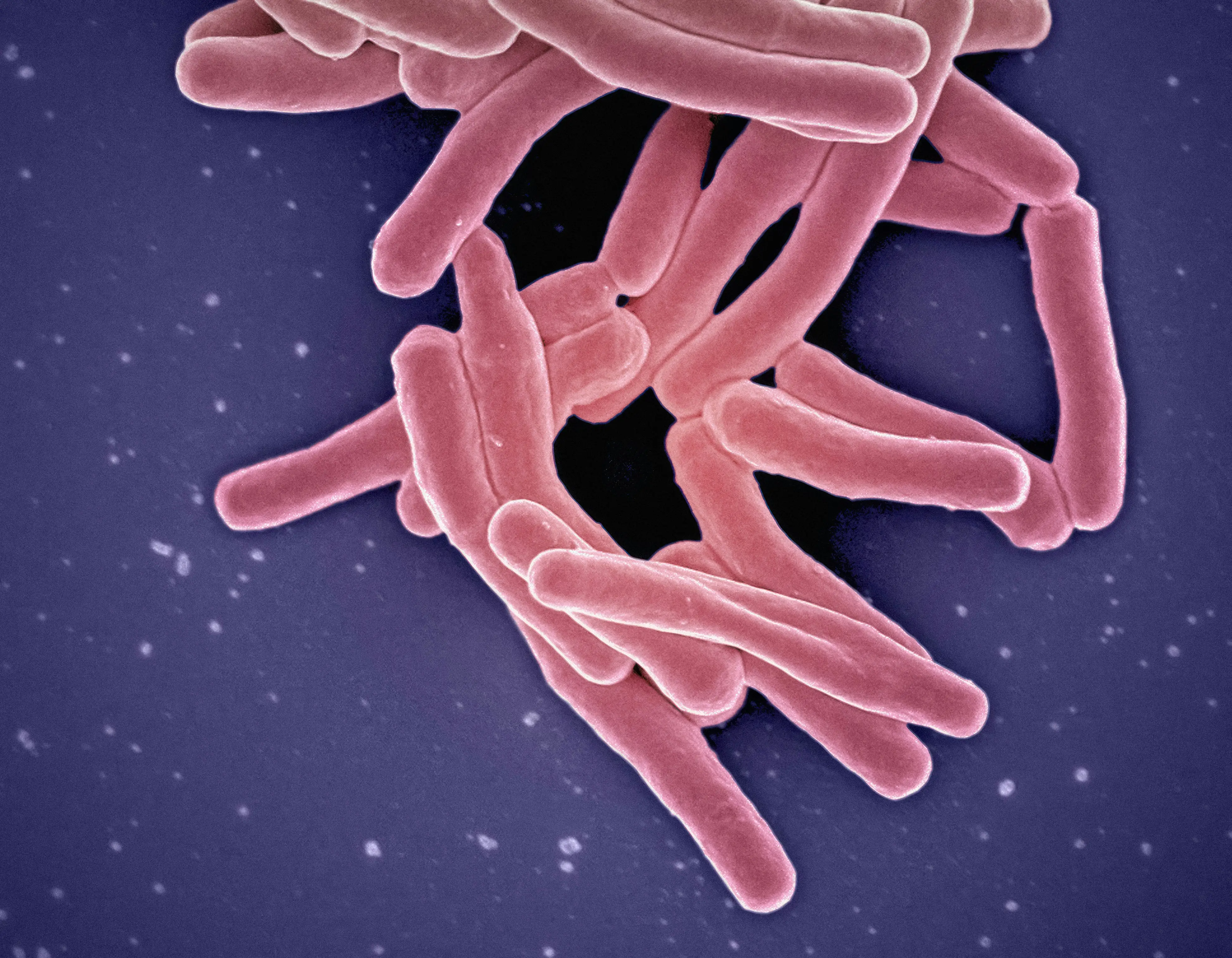 Deadly disease believed eradicated in Britain claims first life since 1901
