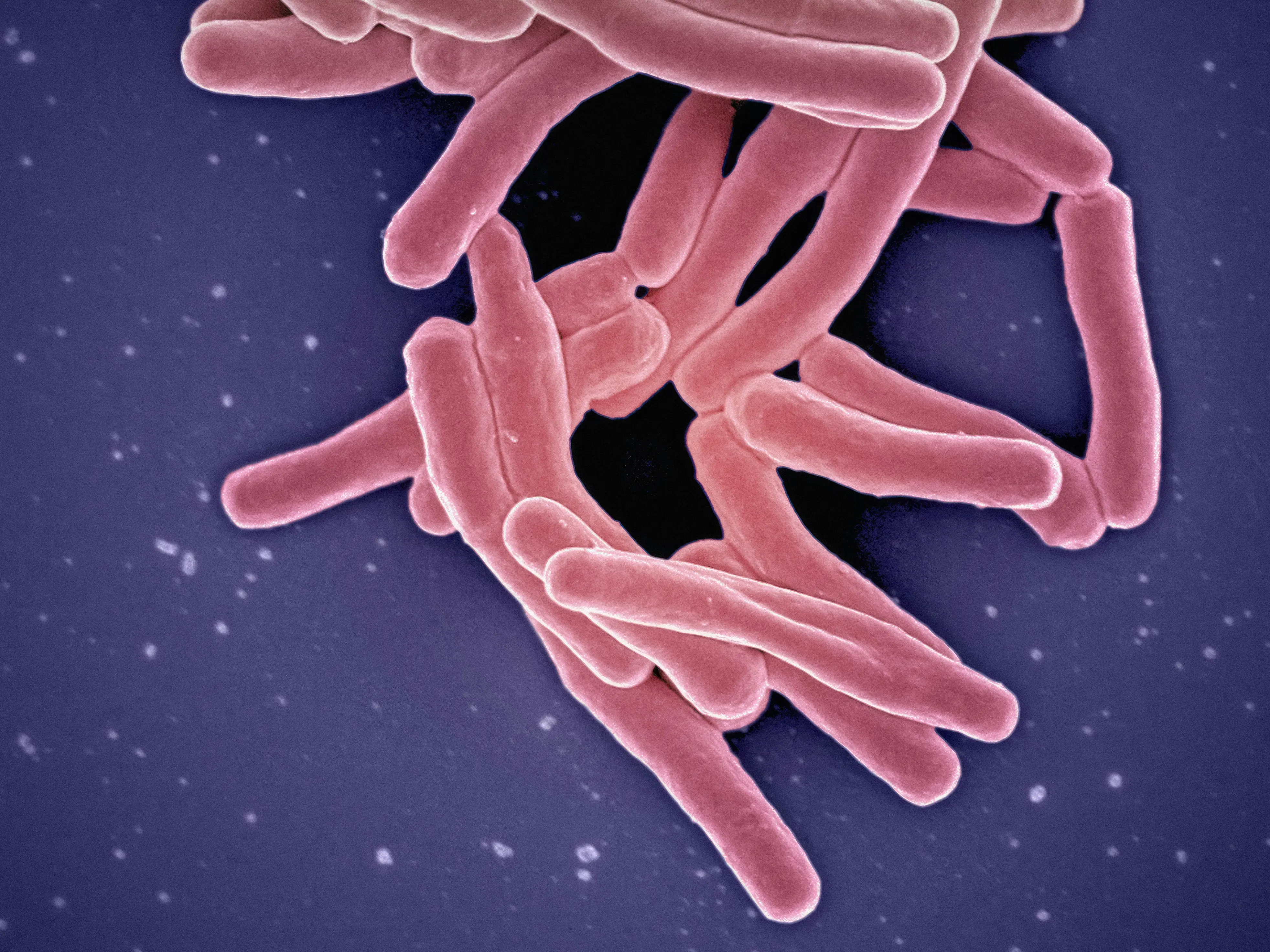 Deadly disease believed eradicated in Britain claims first life since 1901 Deadly disease believed eradicated in Britain claims first life since 1901