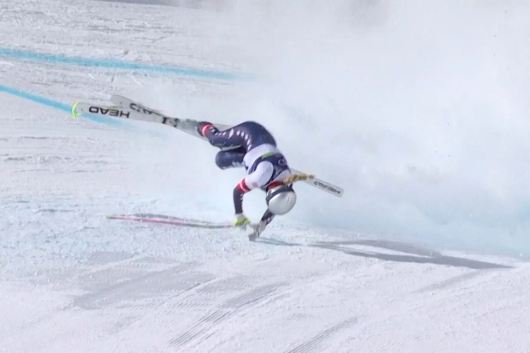 Winter Olympic 2026 | 'Filleted it open': Lindsey Vonn reveals how a torn ACL saved her leg from amputation after horrific crash