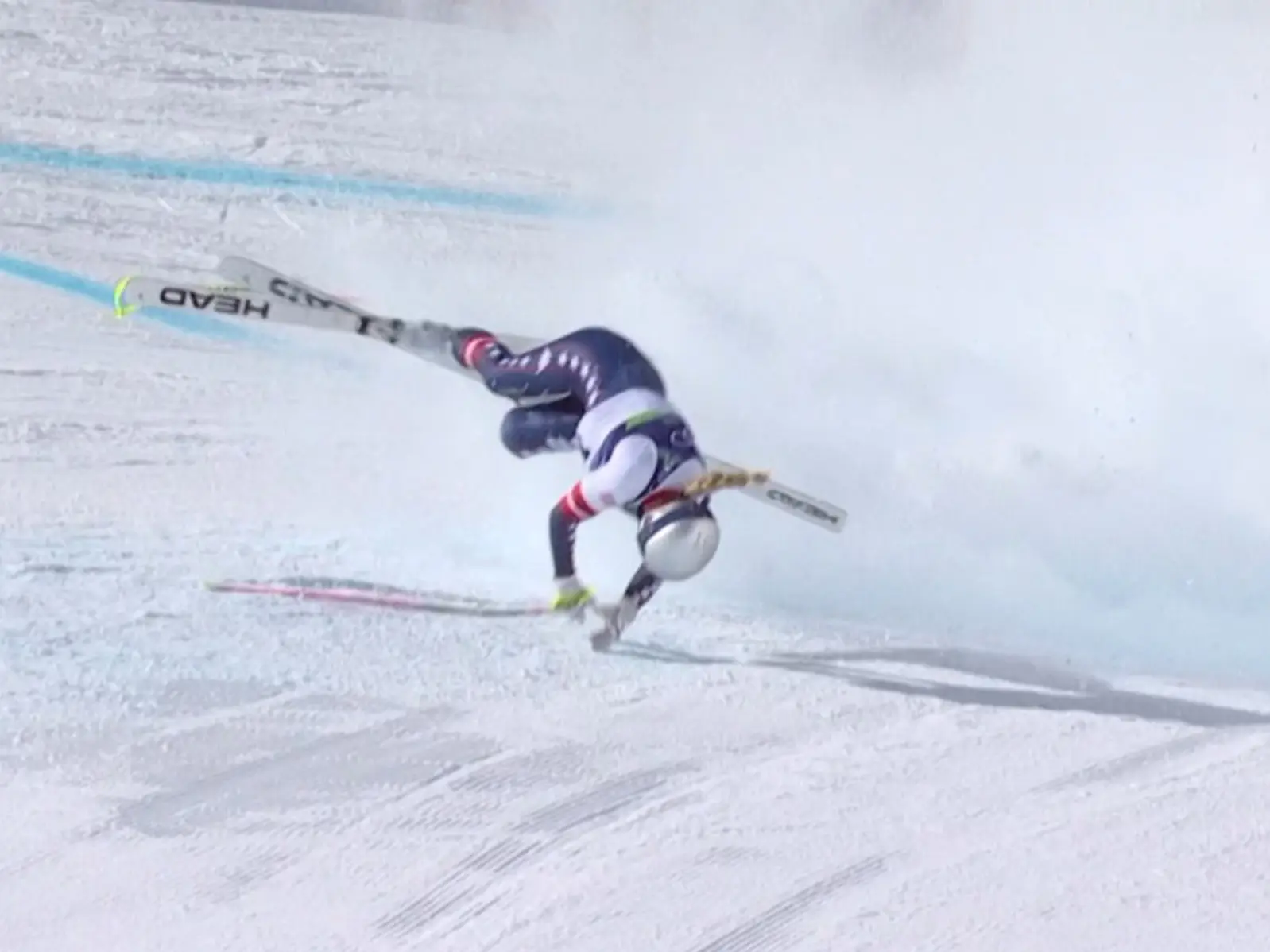 Winter Olympic 2026 | 'Filleted it open': Lindsey Vonn reveals how a torn ACL saved her leg from amputation after horrific crash Winter Olympic 2026 | 'Filleted it open': Lindsey Vonn reveals how a torn ACL saved her leg from amputation after horrific crash