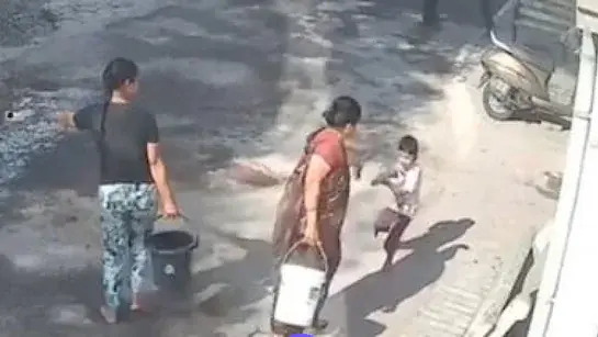 Child severely burned after grandmother allegedly throws boiling water in Nagpur