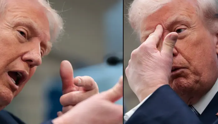 ‘Bruised hand, bald spot’: Trump's latest appearance fuels fresh health speculation amid hospitalisation rumours