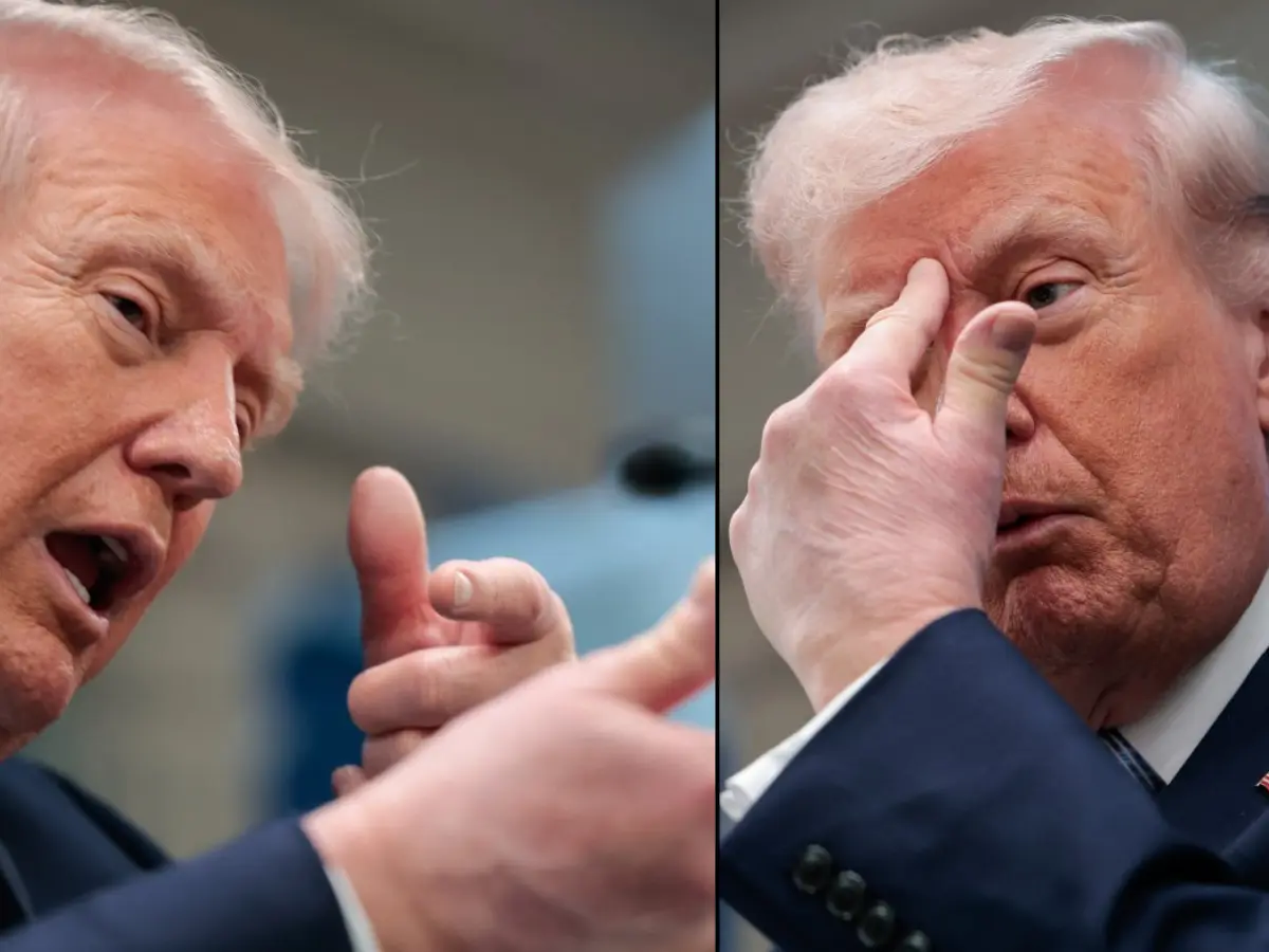 ‘Bruised hand, bald spot’: Trump's latest appearance fuels fresh health speculation amid hospitalisation rumours