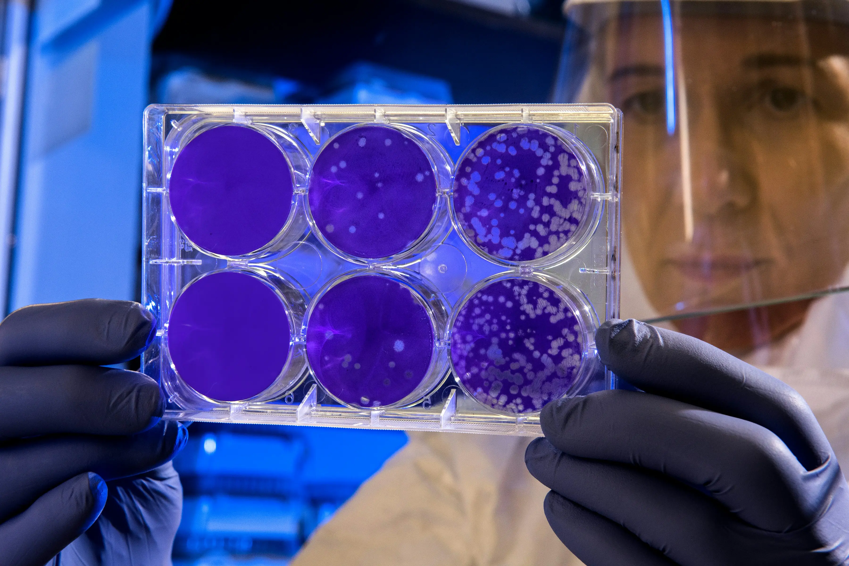 Lesser-known viral or bacterial infections possible culprits