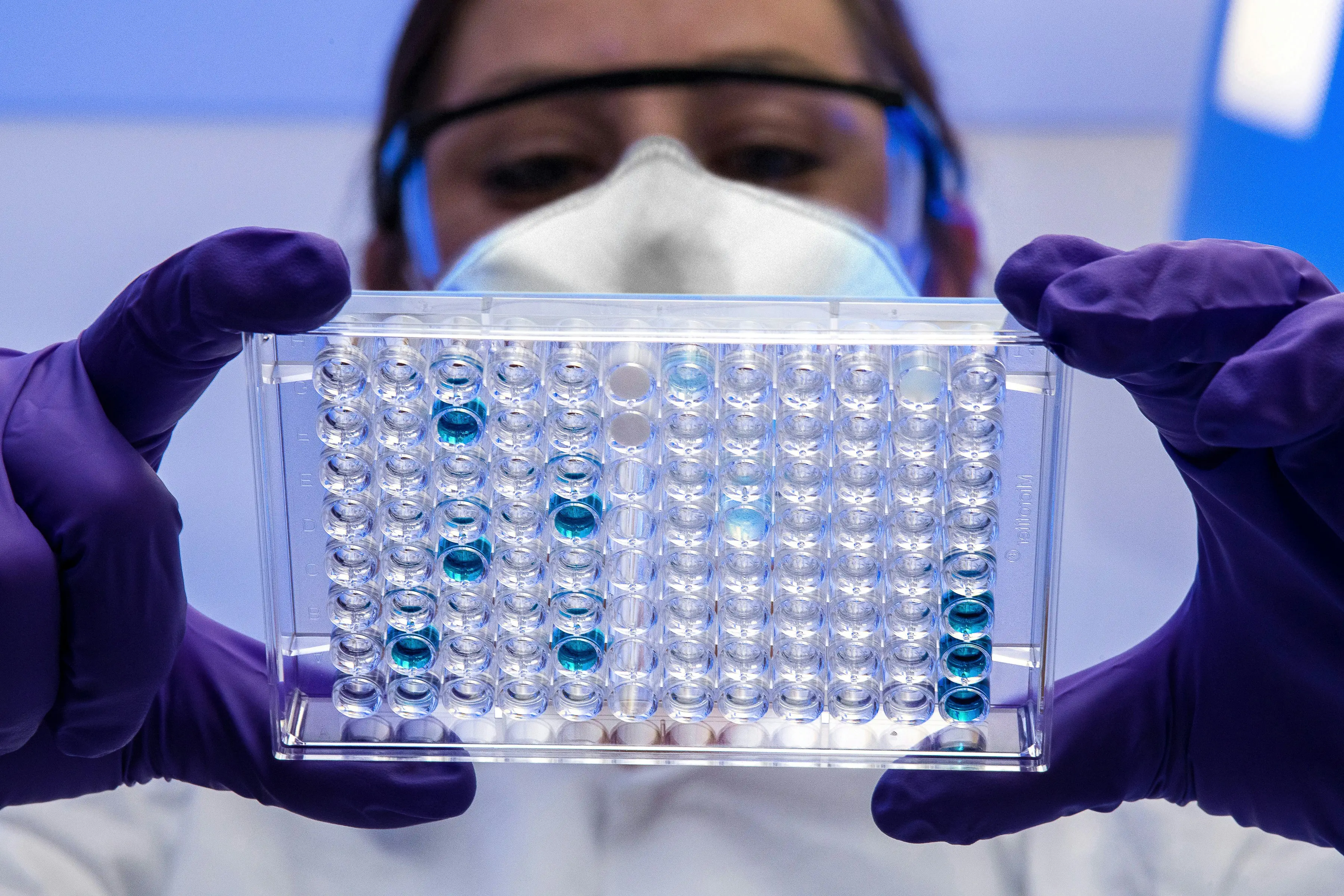 WHO working with Burundi health officials to investigate the mystery disease