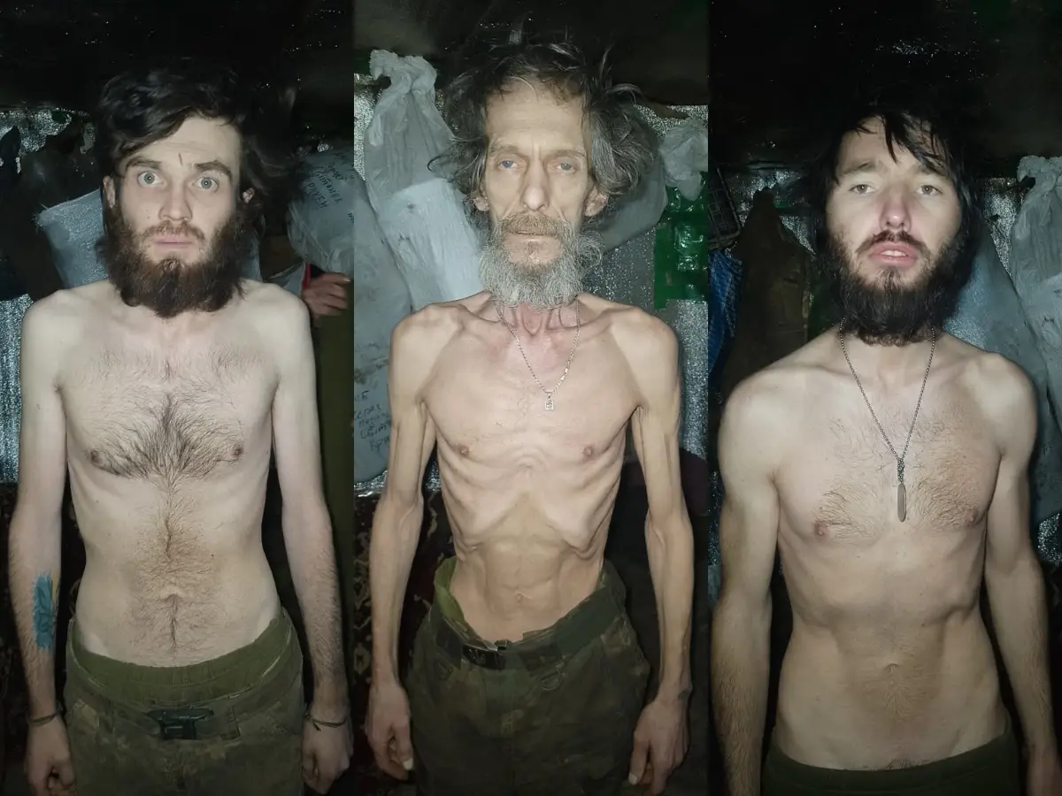 'Extreme situation': Images of starving Ukrainian soldiers go viral, Kyiv says 'logistics are complicated' 'Extreme situation': Images of starving Ukrainian soldiers go viral, Kyiv says 'logistics are complicated'