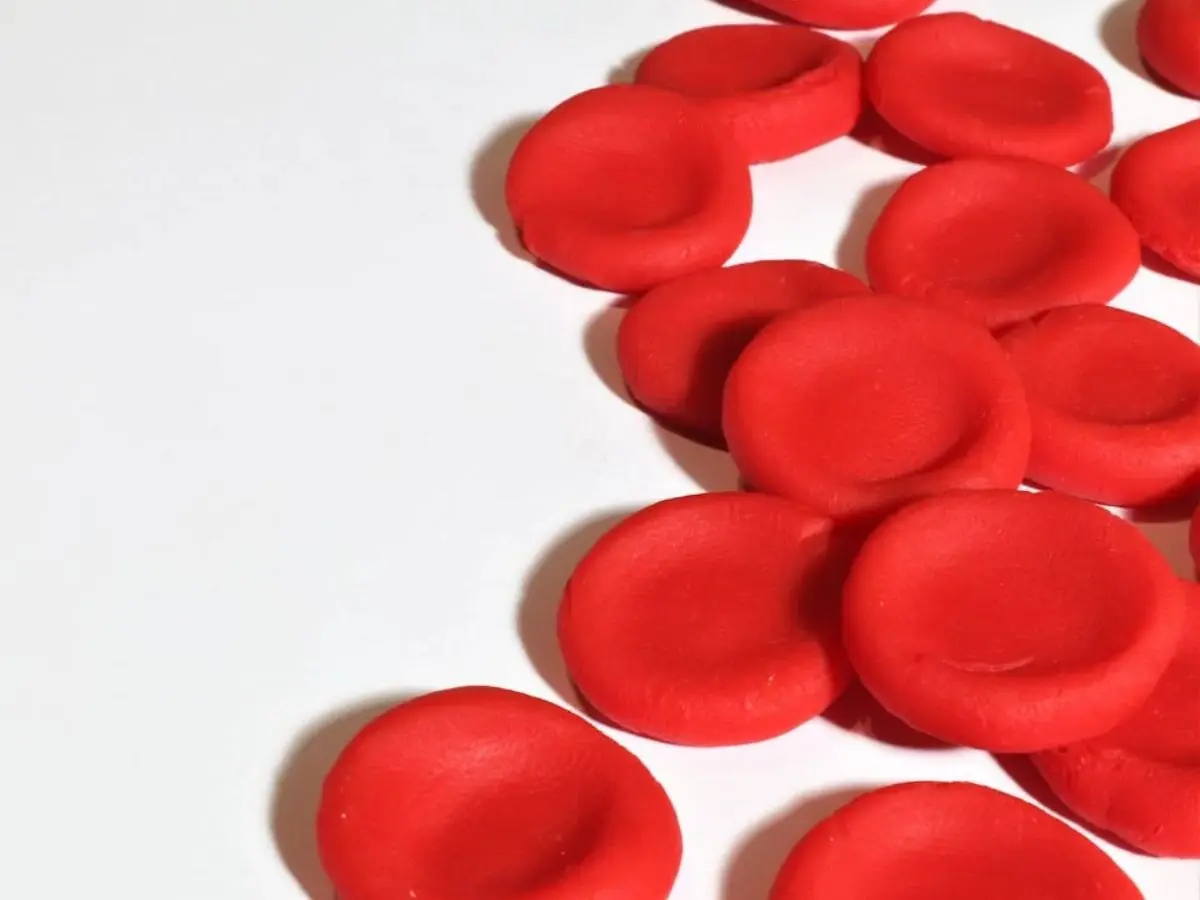 Sickle Cell Disease