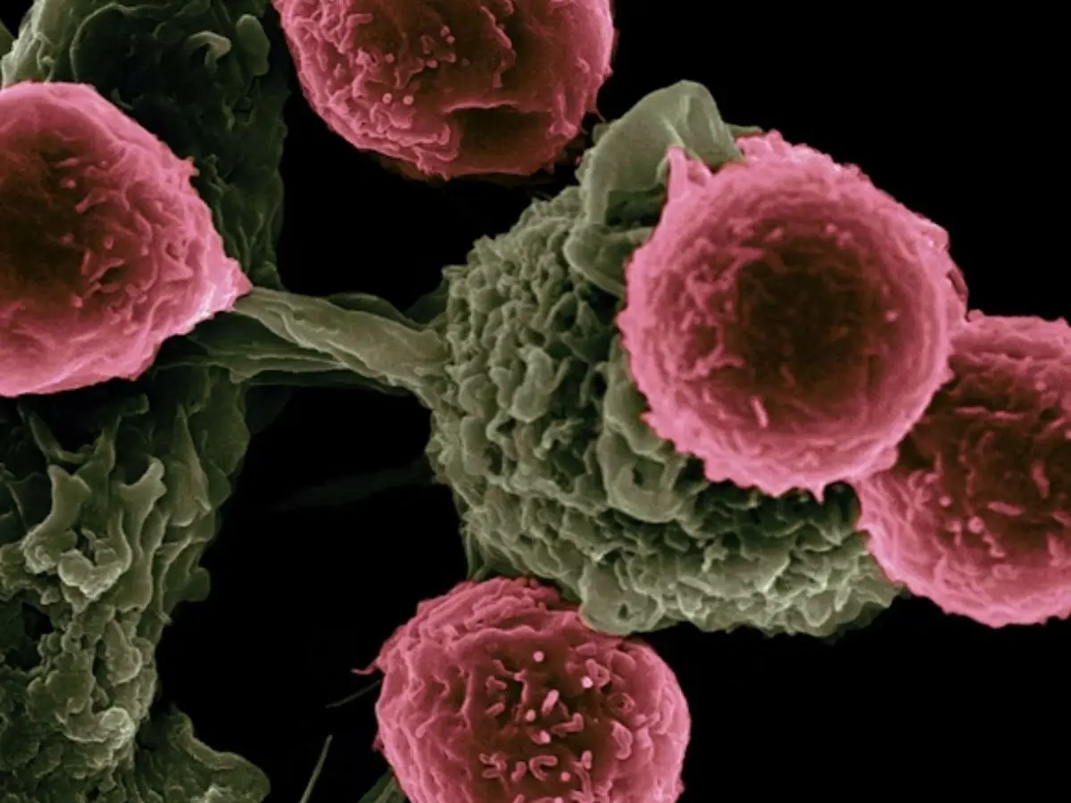 Cancer, in most cases