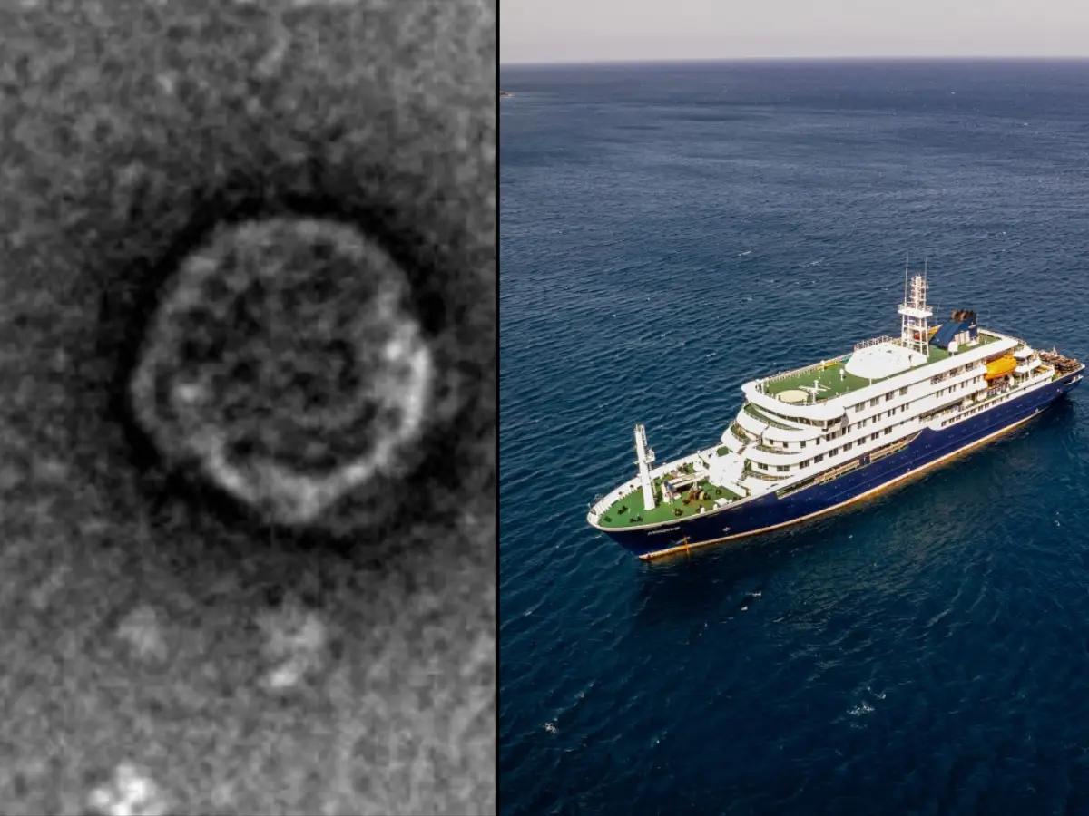 Hantavirus outbreak on cruise ship leaves 3 dead: Past cases date back to 1950s, include Gene Hackman’s wife
