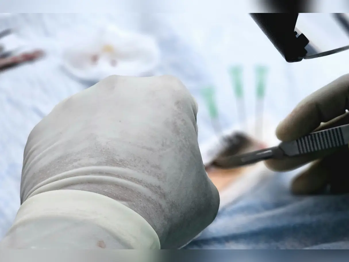 Pakistani Lashkar terrorist infiltrates to set up sleeper cells, gets hair transplant done in Srinagar