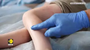 Measles Outbreak Spreads From US to Mexico | Why a Preventable Virus Is Spreading Again