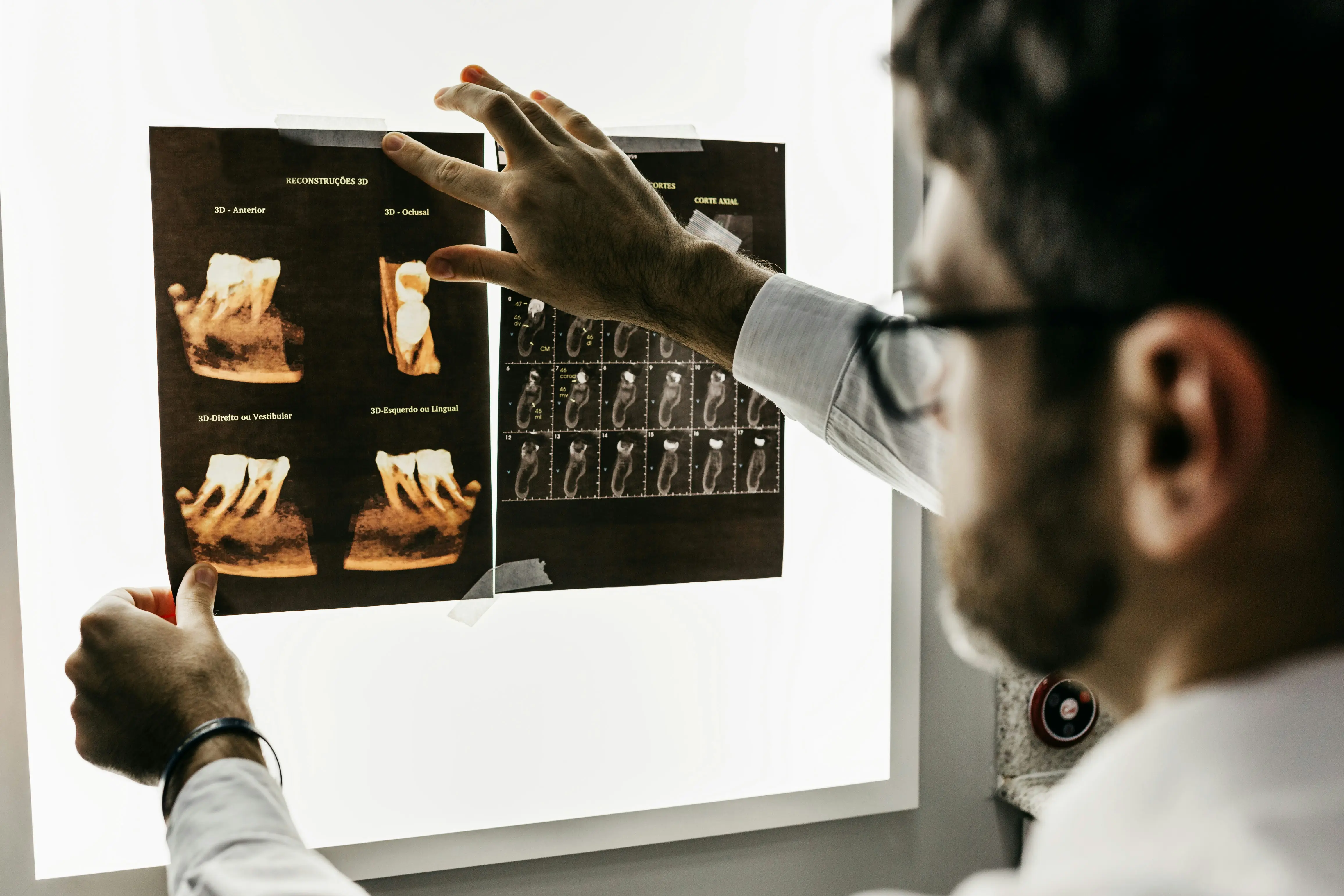 Doctors and NHS could be sued for AI-driven diagnosis errors in UK? Here's what report warns