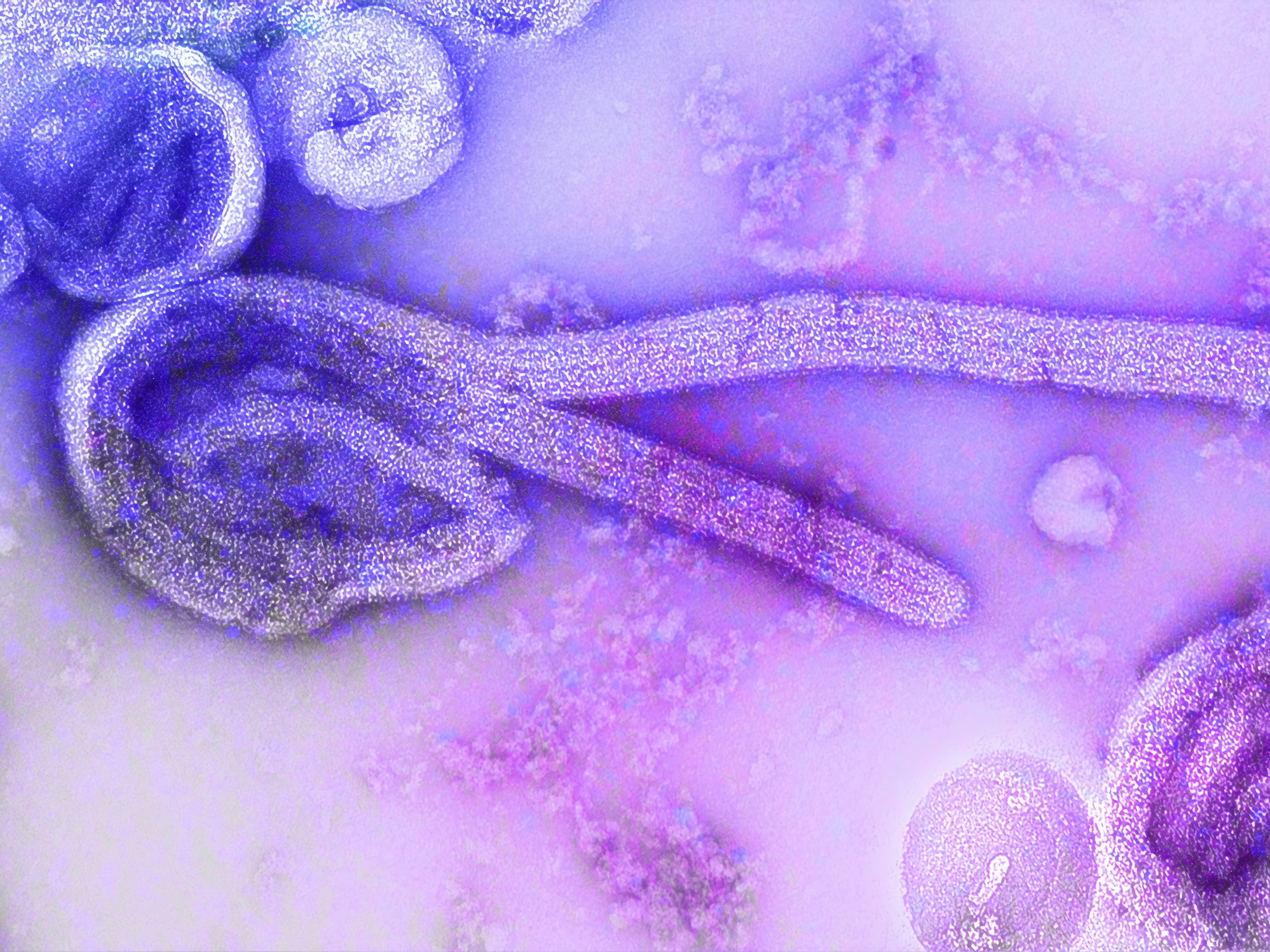 Ebola scare in Kerala: Woman returning from South Sudan falls ill – What we know Ebola scare in Kerala: Woman returning from South Sudan falls ill – What we know