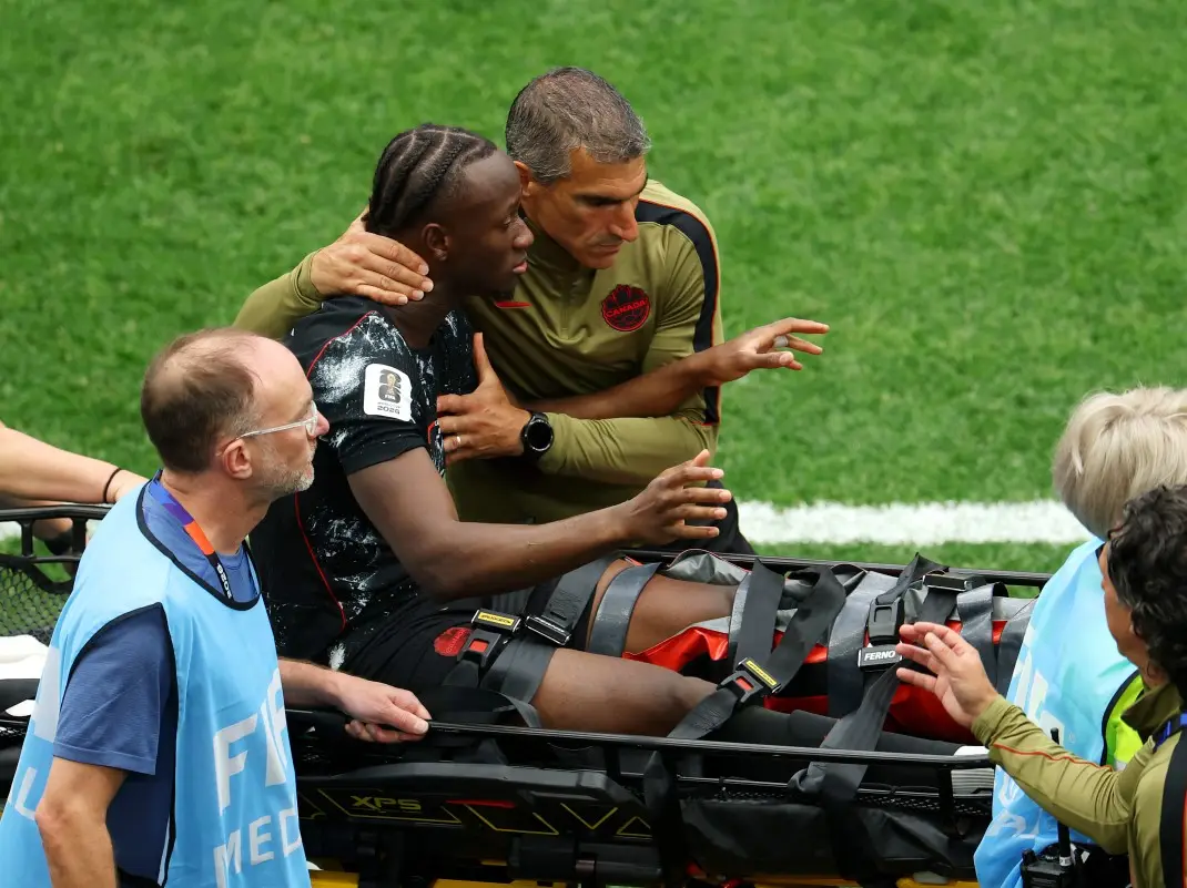 FIFA 2026 Bench Could Hear It Canada Coach Marsch On Kone s Leg fifa-2026-bench-could-hear-it-canada-coach-marsch-on-kone-s-leg