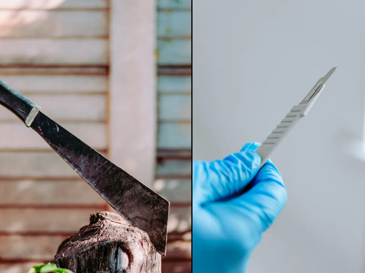 Man cuts his own foot for a nearly Rs 3 crore insurance pay out. THIS tiny detail exposed his fraud Man cuts his own foot for a nearly Rs 3 crore insurance pay out. THIS tiny detail exposed his fraud