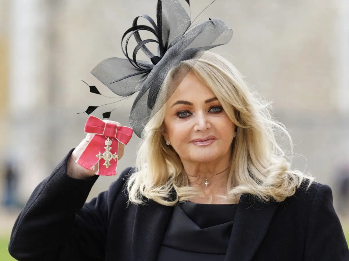 Bonnie Tyler, 74, the Welsh pop icon, dies following emergency intestinal surgery and coma
