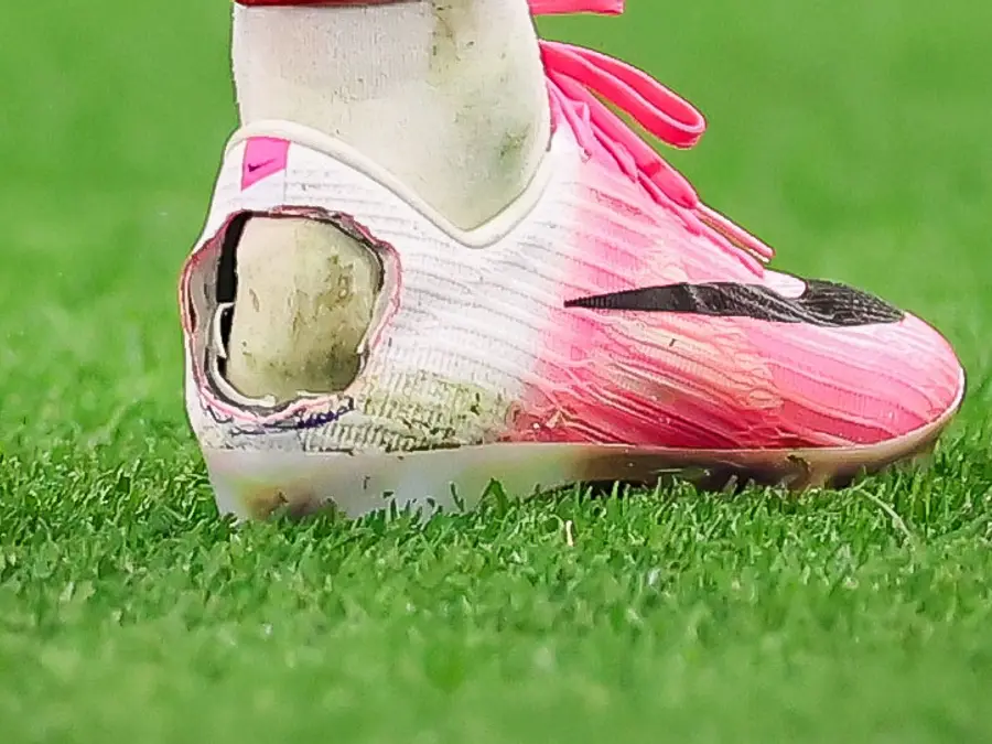 Why did Pedro Neto cut a hole in his football boot? The Haglund's deformity explained