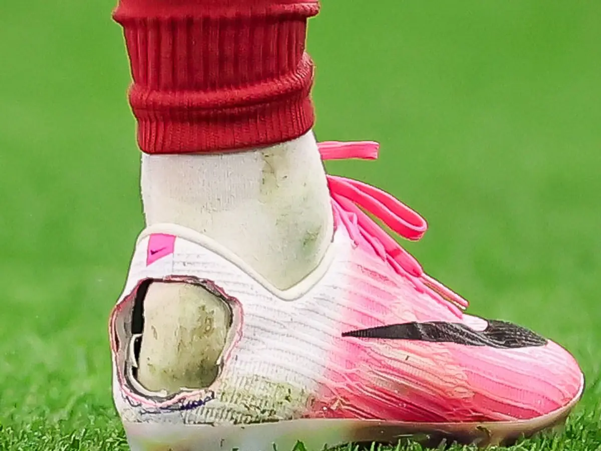 Warum schnitt Pedro Neto ein Loch in seinen Fußballschuh? Die ...