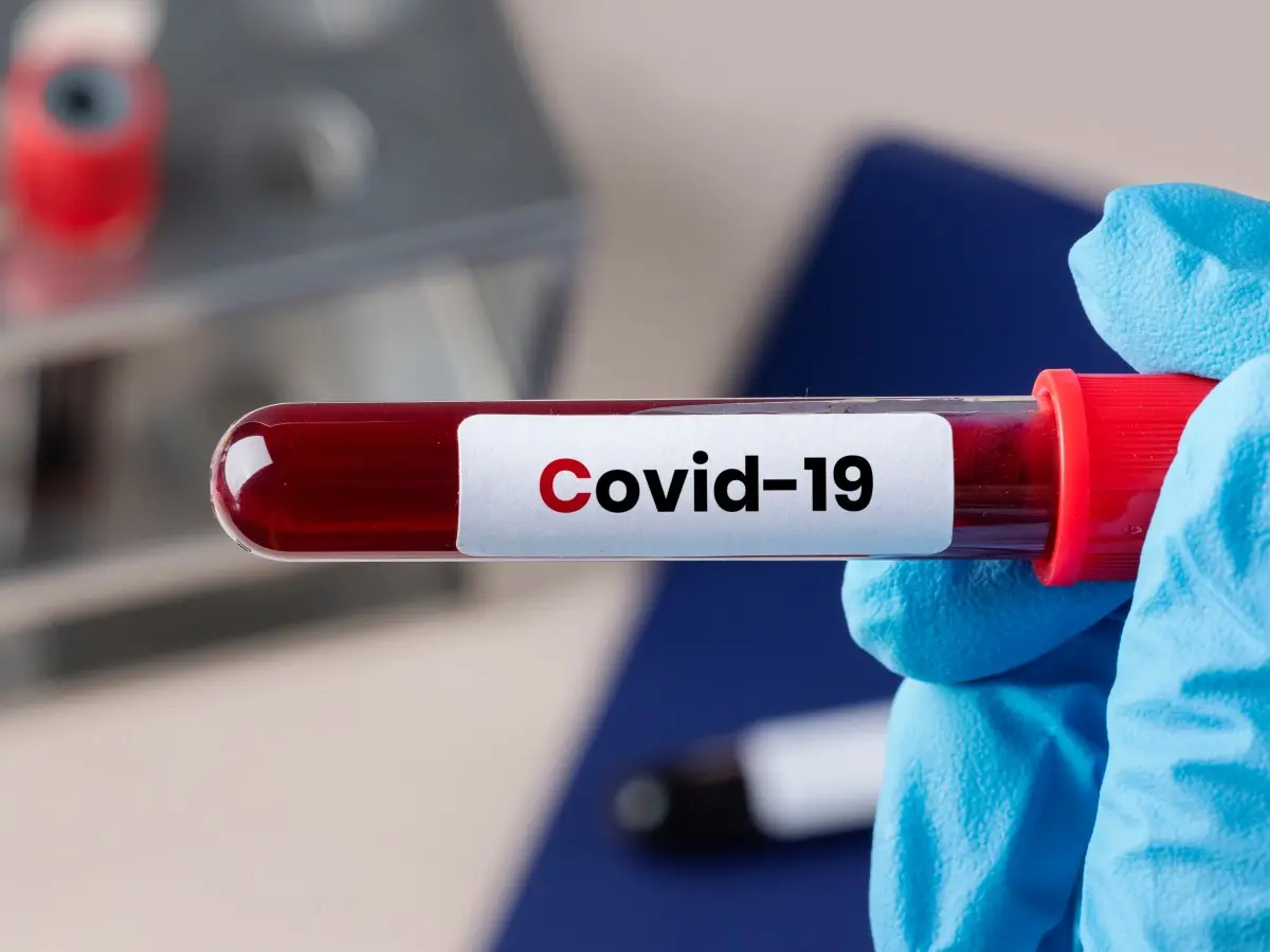 Andhra Pradesh logs 12 new Covid-19 cases, four deaths since late June; officials urge calm