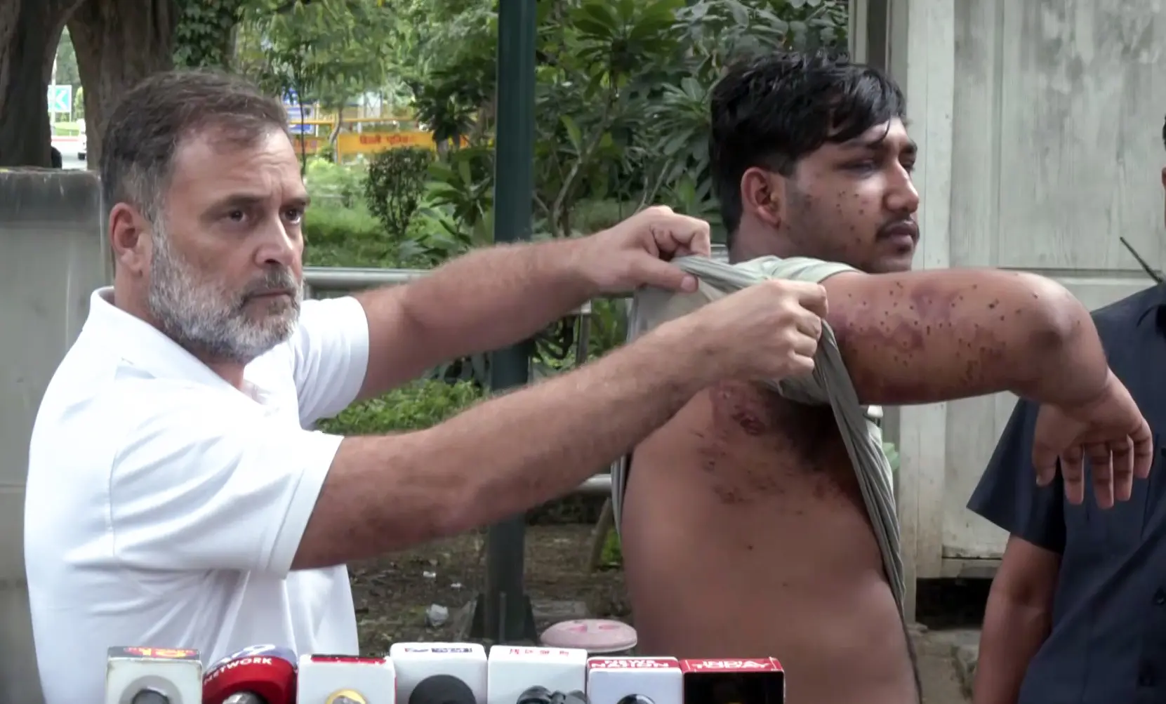 'Not sure if his vision will be saved': Rahul Gandhi attacks Centre over pellet gun use