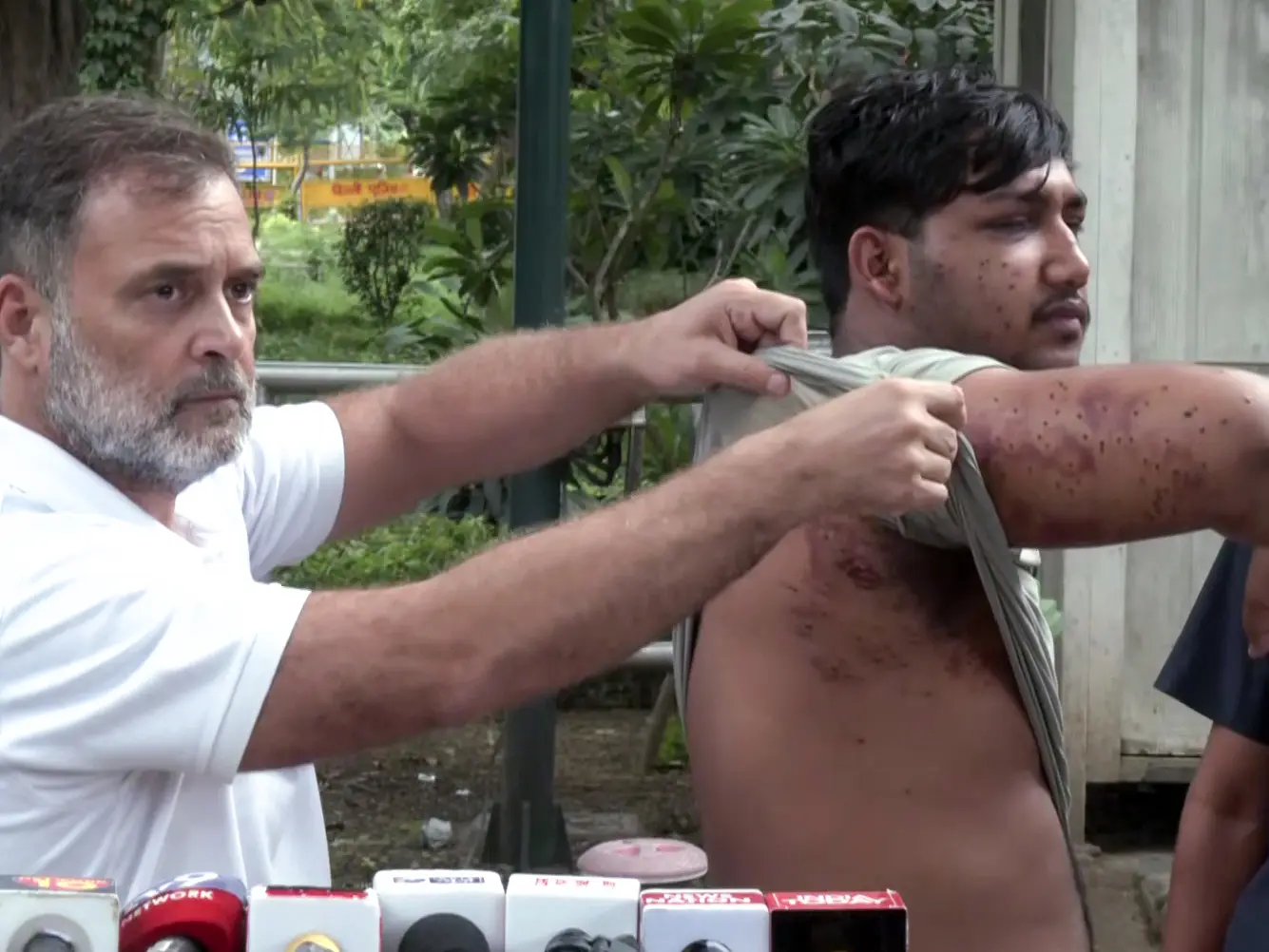 'Not sure if his vision will be saved': Rahul Gandhi attacks Centre over pellet gun use 'Not sure if his vision will be saved': Rahul Gandhi attacks Centre over pellet gun use