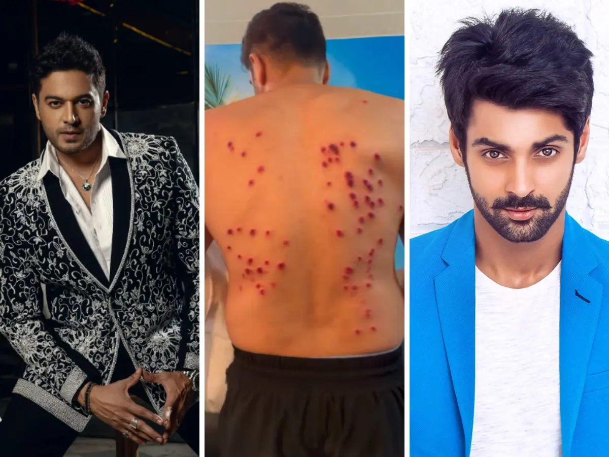 Gaurav Khanna, Karan Wahi and others suffer injuries on Khatron Ke Khiladi 15; Netizens blast 'cruel' pellet gun task