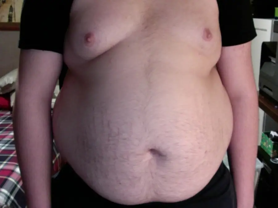 Why belly fat matters more than the number on the scale? GRAVITAS
