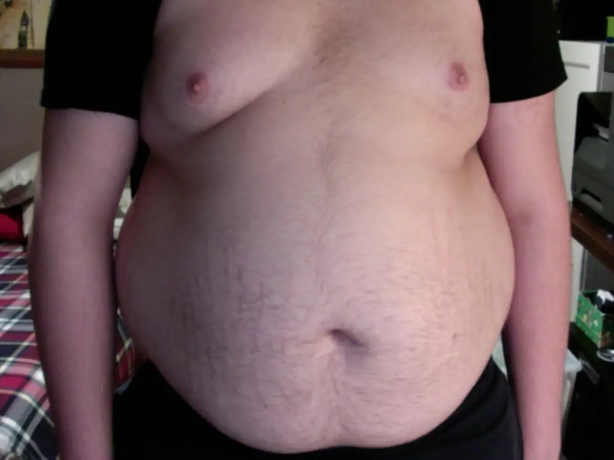 Why belly fat matters more than the number on the scale? GRAVITAS Why belly fat matters more than the number on the scale? GRAVITAS