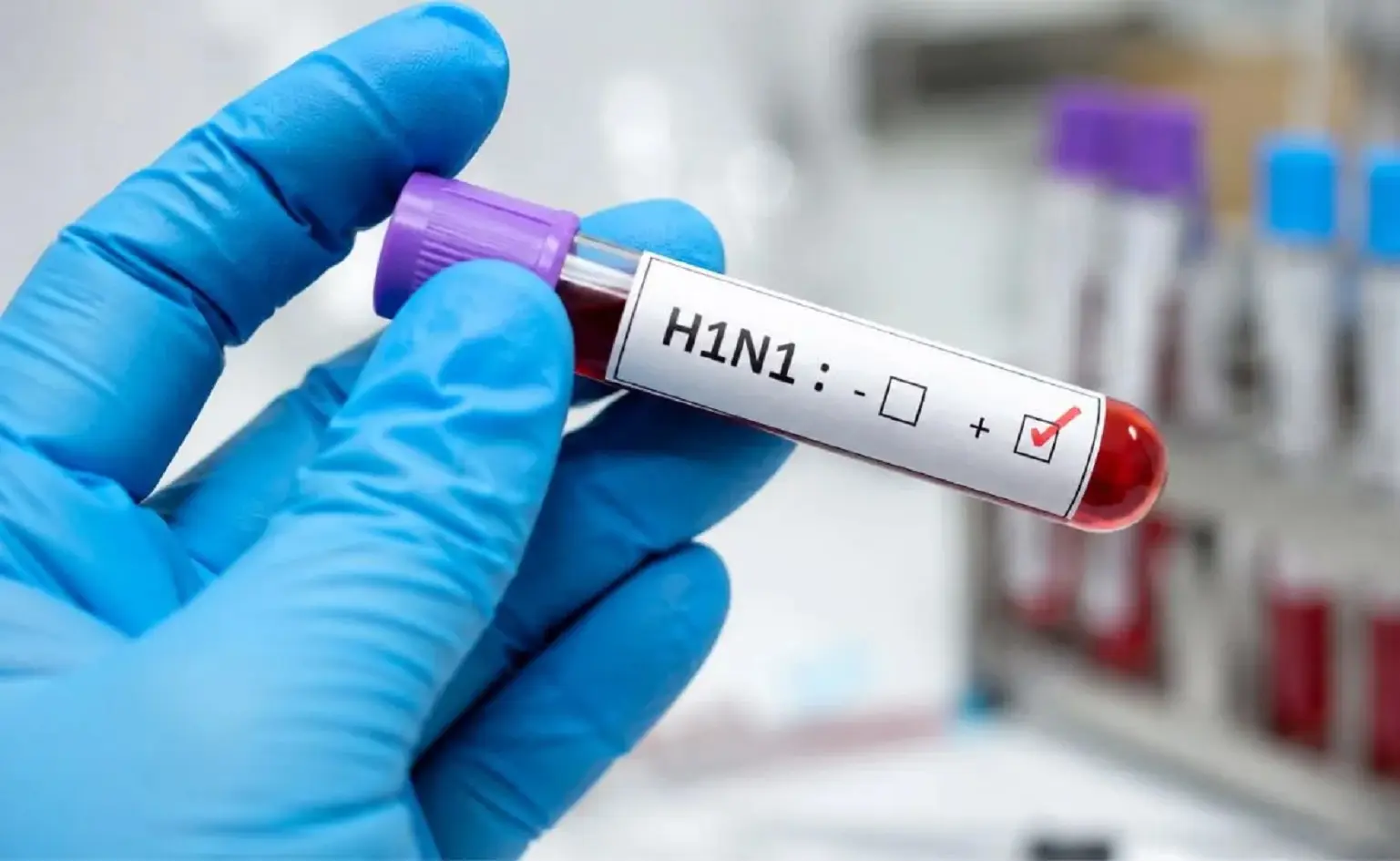 ‘No cause for panic’: ICMR says no new H1N1 strain detected, urges caution for high-risk groups