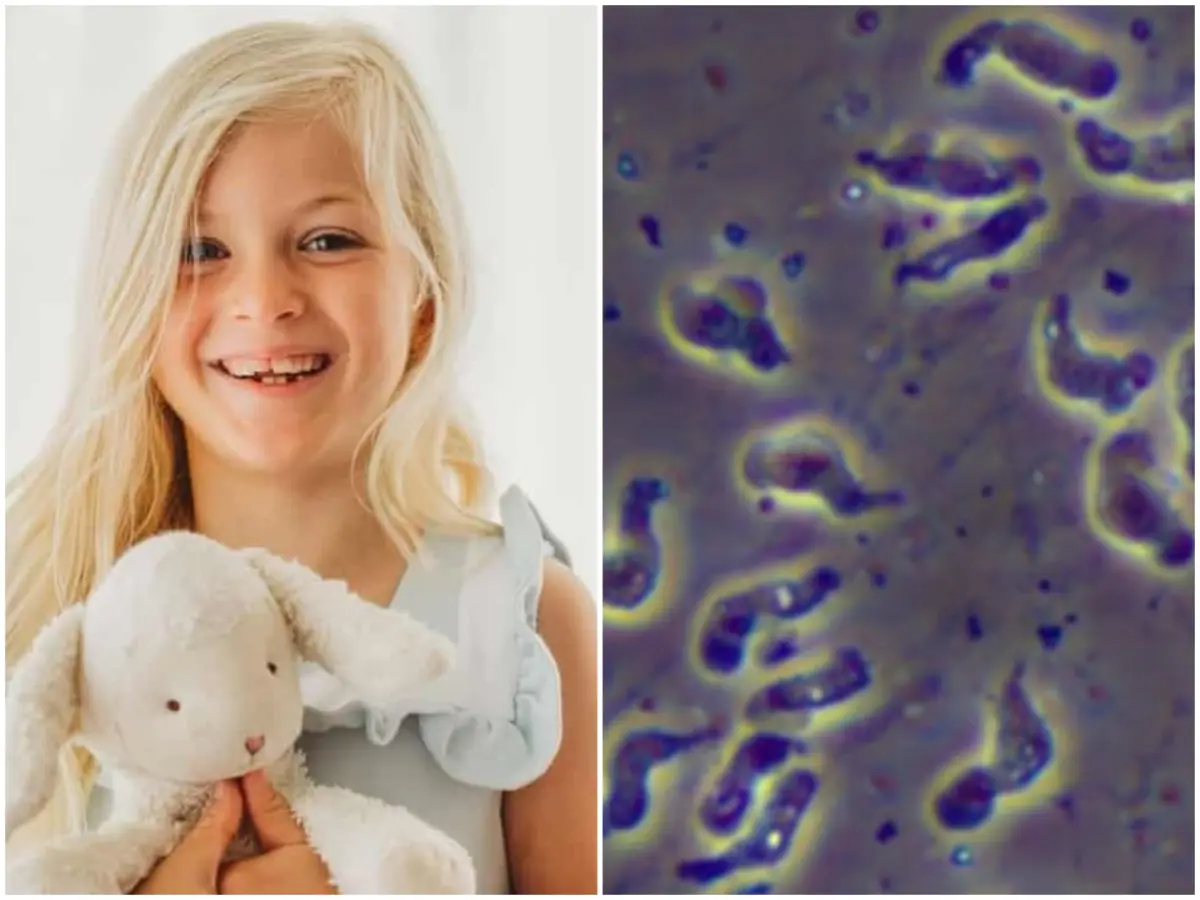8-year-old Louisiana girl dies from rare brain-eating amoeba linked to lake swim 8-year-old Louisiana girl dies from rare brain-eating amoeba linked to lake swim