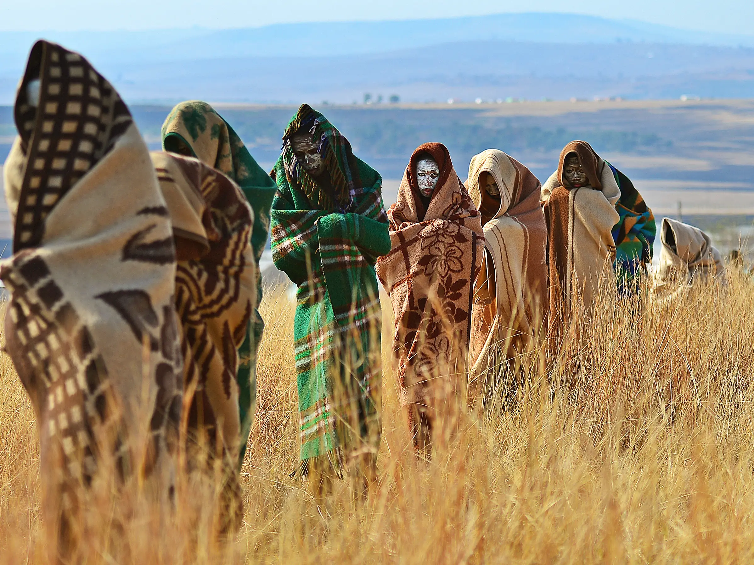 43 teenage boys die of botched mass circumcisions in South Africa 43 teenage boys die of botched mass circumcisions in South Africa