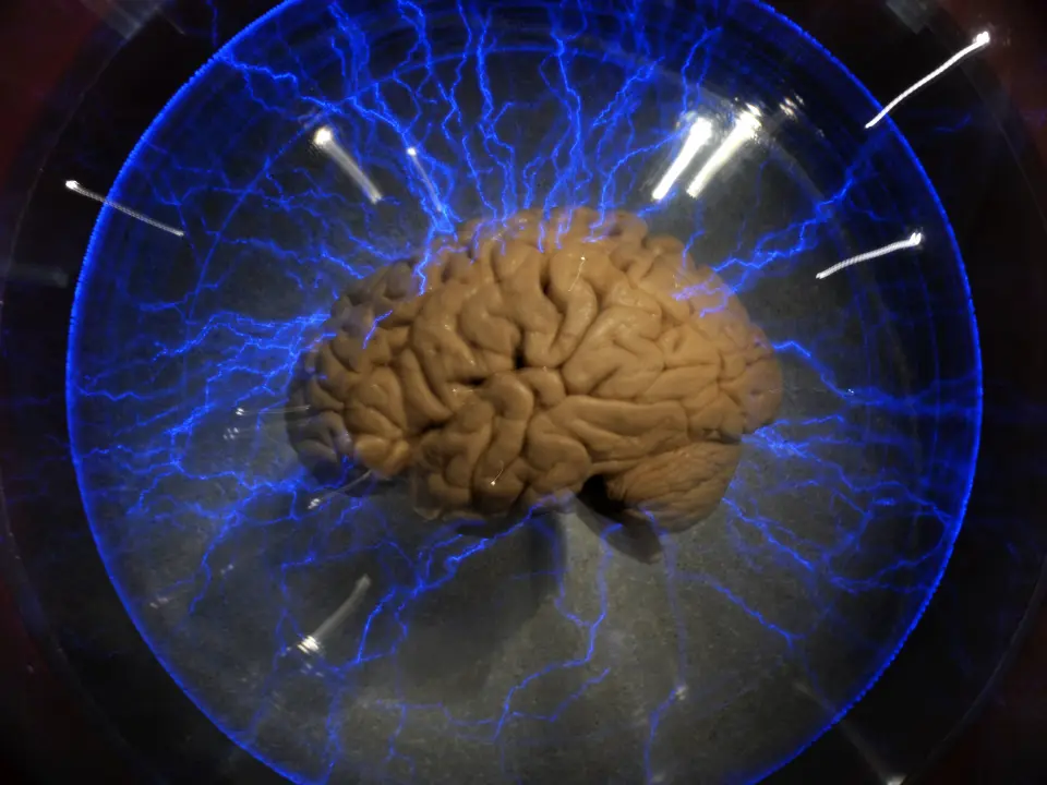 In two minds? Human brain is not one, but two separate organs In two minds? Human brain is not one, but two separate organs