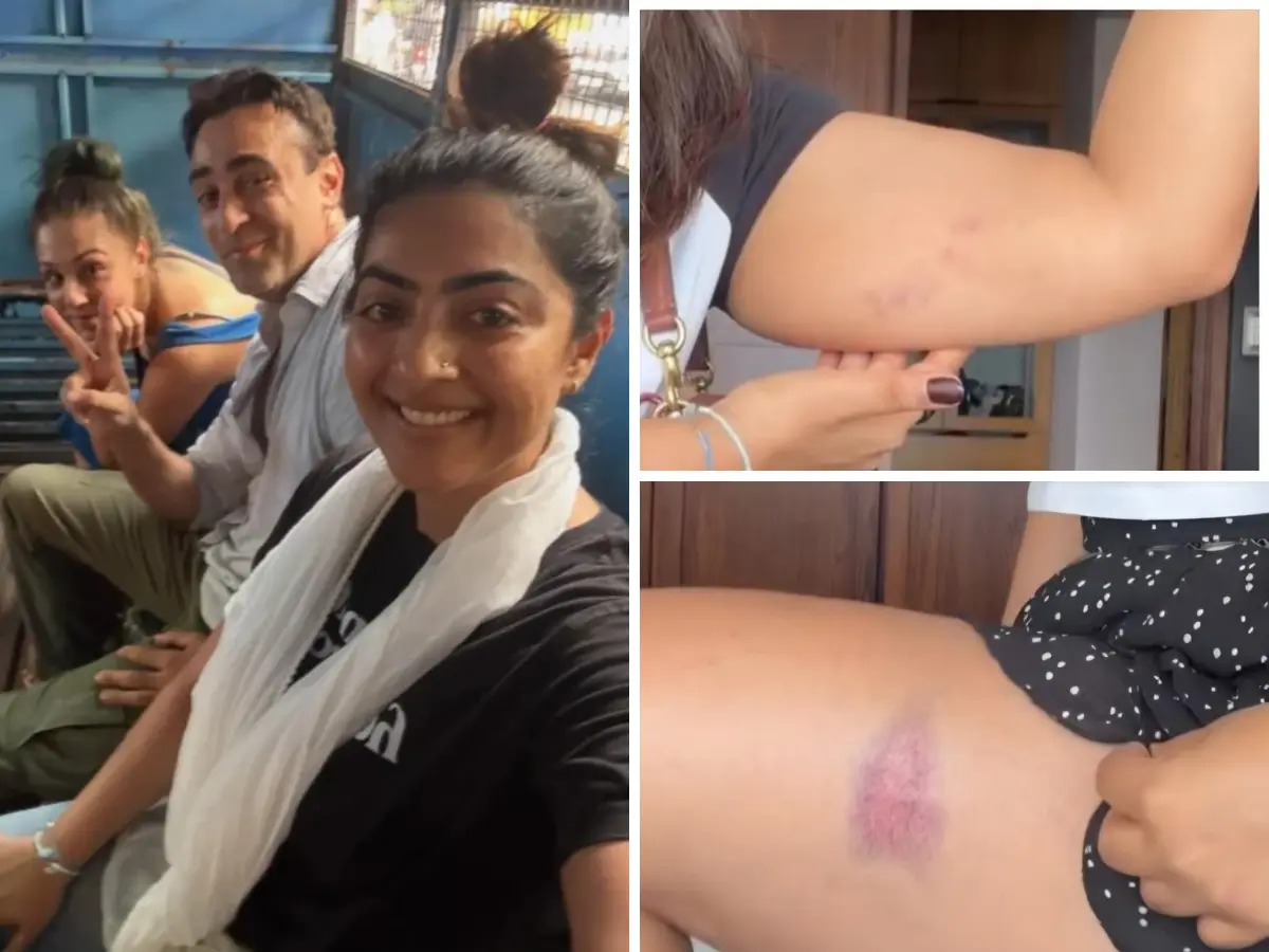 Aamir Khan's niece, actress Zayn Marie shares injury pictures after being detained with Imran Khan at Mumbai protest